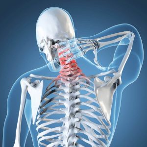 Neck Related Injuries